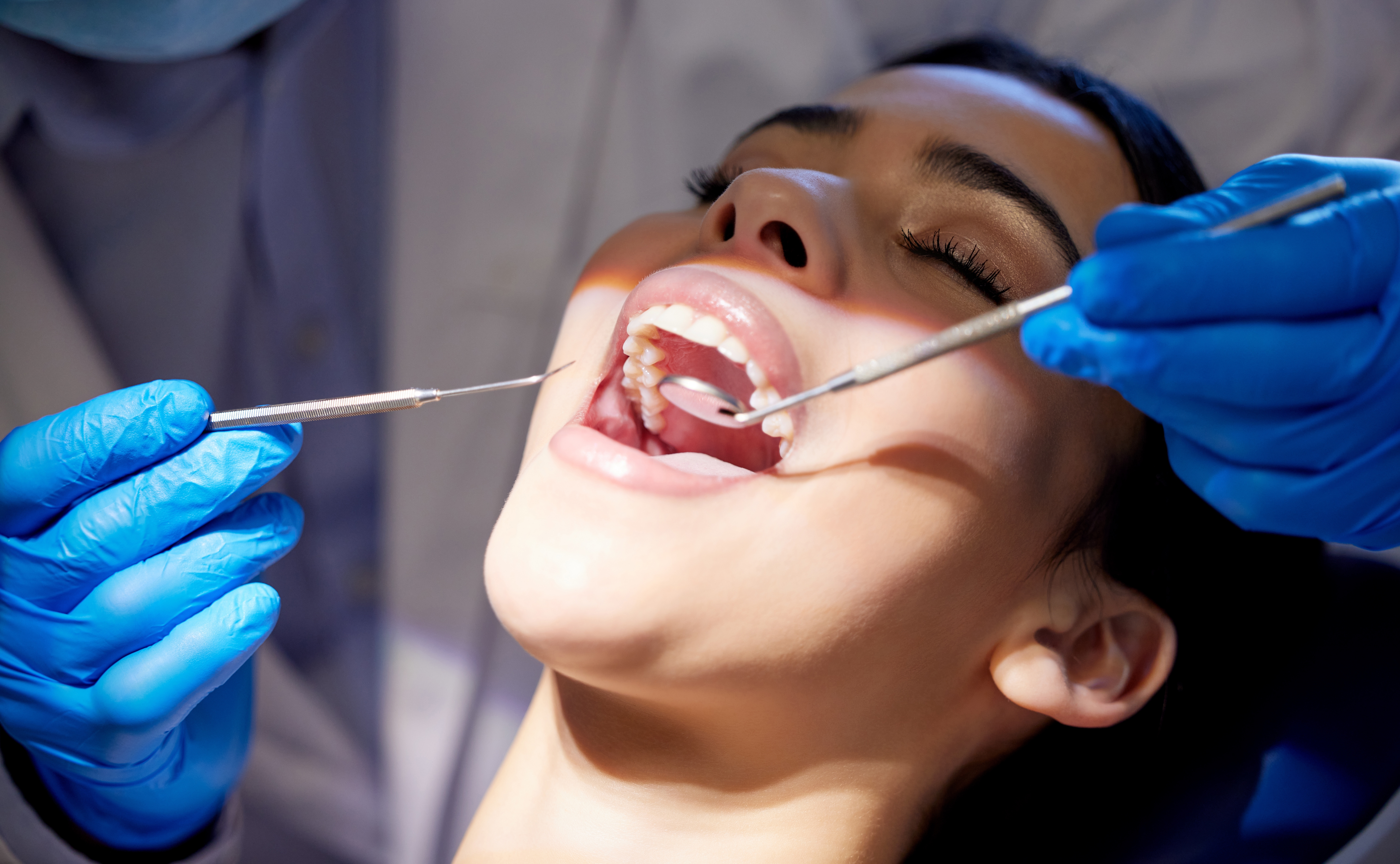 clear braces on plastic model